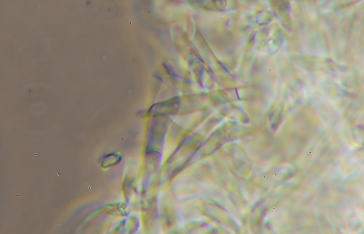 Crosta bianca da det. - foto 4462 (Heterobasidion abietinum)